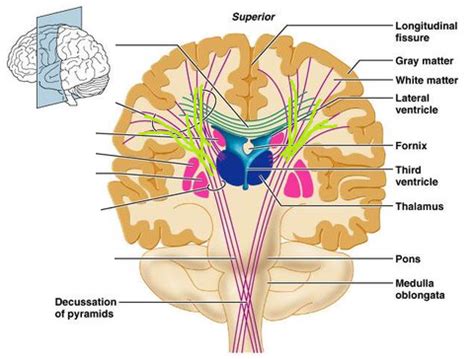 Level 3 - Neurology, ENT, & Ophthalmology (Images) - Oxford Medicine … - Memrise