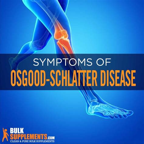 Osgood-Schlatter Disease: Symptoms, Causes & Treatment