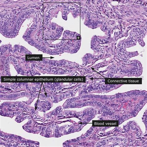 Dictionary - Normal: Fallopian tube | Fallopian tubes, Glandular cells ...