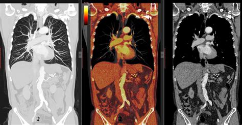 CT Scan Vs. PET Scan: What’s the Difference? — Radiology Associates of Ocala