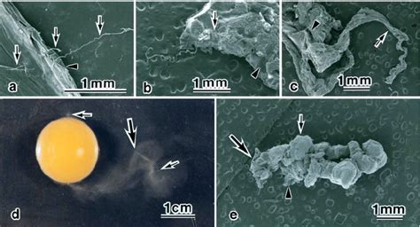 Scanning electron (SEM) and light (LM) micrographs of chalazae from ...