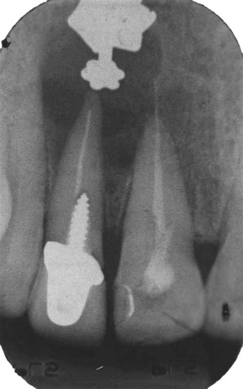 Dental Radiography: Film Faults. Quiz #1 : Enhanced Dental CPD Online