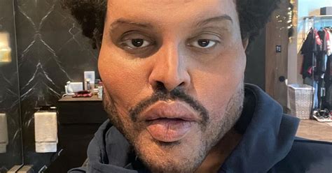 The Weeknd shows off bloated 'plastic surgery' face in freaky music video - Mirror Online