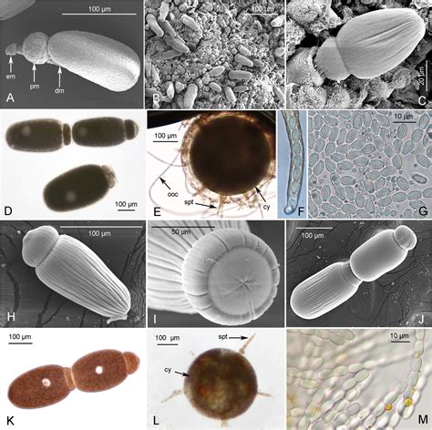 Integrative taxonomy confirms that Gregarina garnhami and G. acridiorum ...