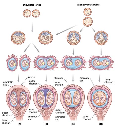 Opposite sex in identical twins: Does it really happen?