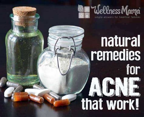 Natural Remedies for Acne - Wellness Mama