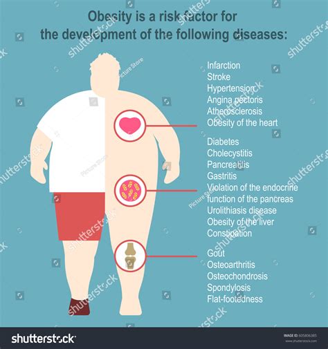 1,779 Effects of obesity Images, Stock Photos & Vectors | Shutterstock