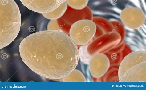 Candida Fungi As A Cause Of Otitis Media Royalty-Free Cartoon ...