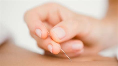 Dry needling for headaches - Melbourne Osteopathy Sports Injury Centre