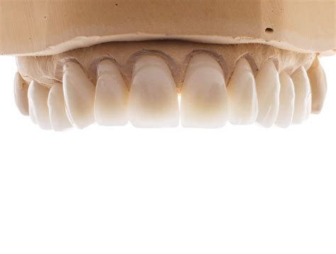 What is the best Cad Cam Crown Material? - Dental Lab Shop