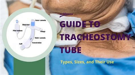 Guide to Tracheostomy Tube : Types, Sizes, and Their Use