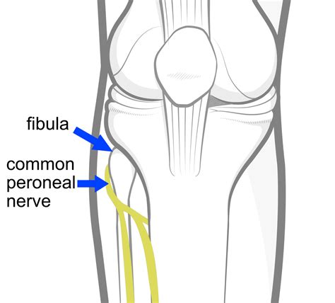 Knee Injuries