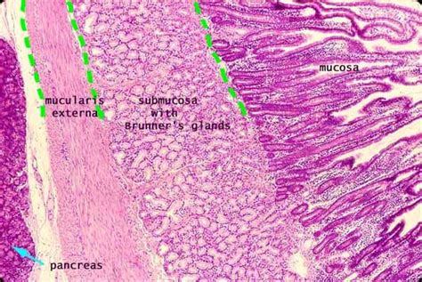 Histology - Small Intestine - Duodenum Histology Slides, Medicine Notes, Microscopic Photography ...