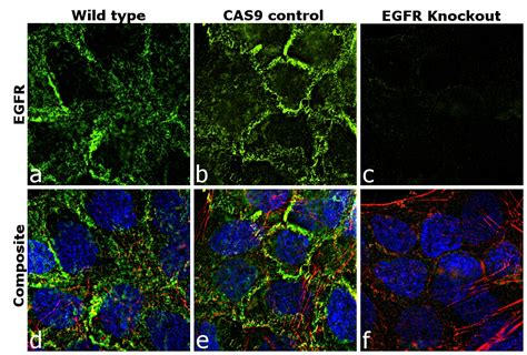 EGFR Antibody (MA5-13319)