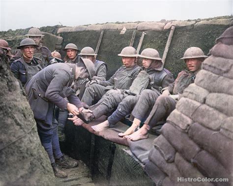 Trench Foot Inspection WW1 – Colorized Historical Pictures