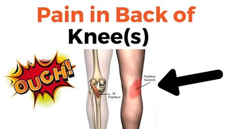 Pain In Back Of Knee After Walking or Sitting Too Long Back Of Knee Pain : What's Wrong? - YouTube