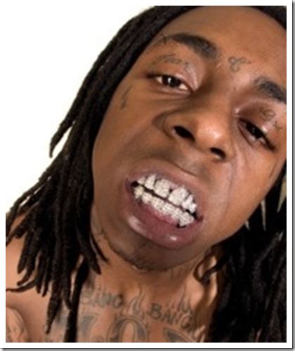 lil wayne teeth before