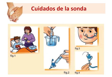 El Blog para las Cuidadoras.: Cuidados de la sonda nasogástica