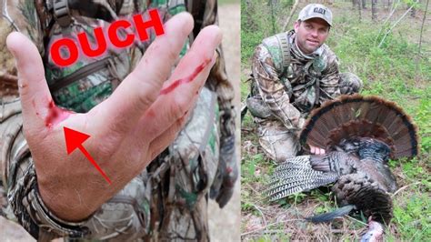 Turkey ATTACKS Hunter... (OUCH!) - YouTube