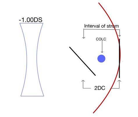 Astigmatism charts - OptomInSight