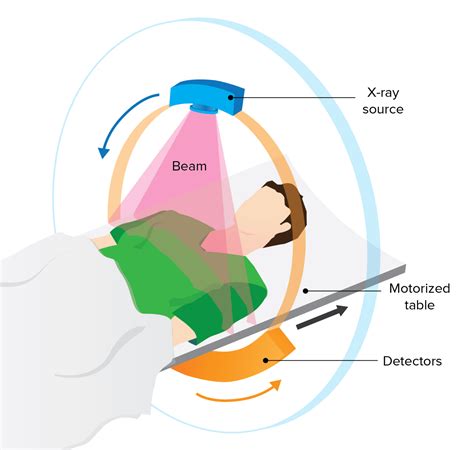 Computed Tomography (CT) | Concise Medical Knowledge