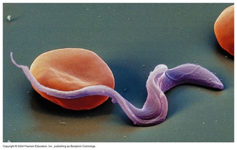 Trypanosoma cruzi and erythrocyte | Medical laboratory science, Medical words, Microscopic ...