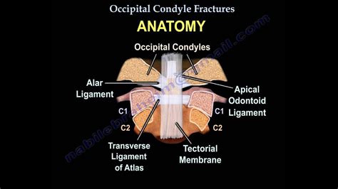 Occipital Condyle Fractures - Everything You Need To Know - Dr. Nabil ...