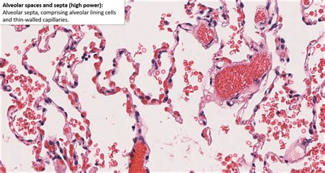 Lung – Normal Histology – NUS Pathweb :: NUS Pathweb