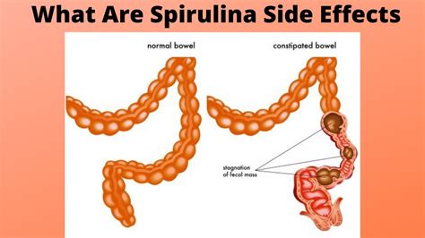 Spirulina Benefits Side Effects