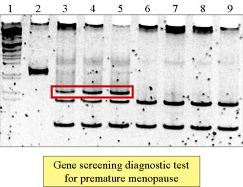 Gel electrophoresis results — Science Learning Hub