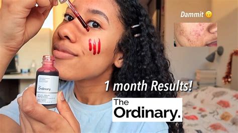 The Ordinary Peeling Solution before and after Review! (12 weeks) - YouTube