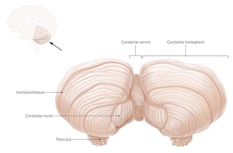 Cerebellar Vermis Tonsils