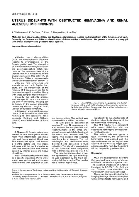 (PDF) Uterus didelphys with obstructed hemivagina and renal agenesis: MRI findings