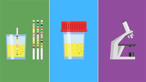 Urinalysis Results Urinary