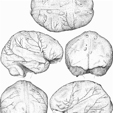 Anterolateral view of the original skull of Cro-Magnon 1; top row ...