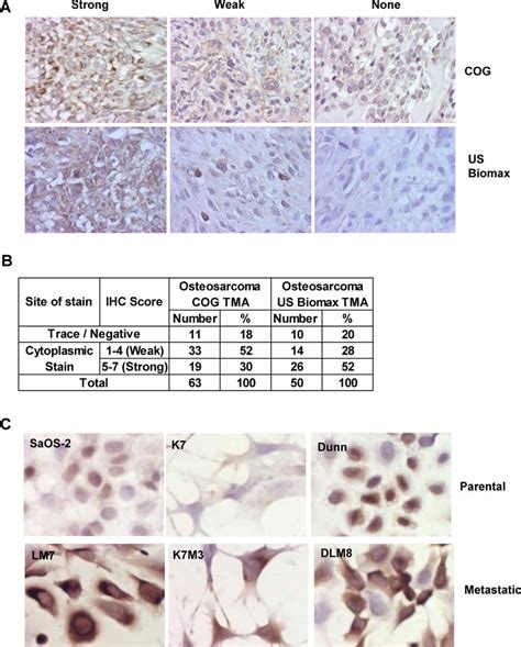 The p27 protein exhibits cytoplasmic localization in OS cases and ...