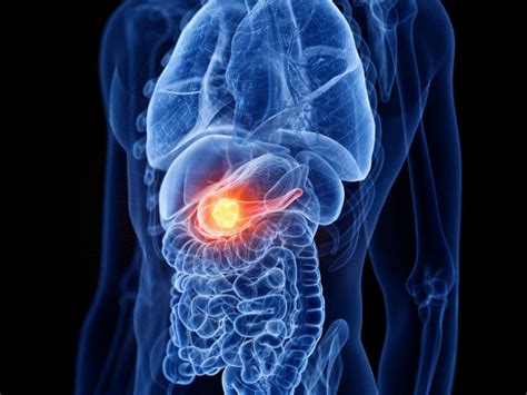 Adagrasib Shows Promising Activity in Gastrointestinal Cancers - Cancer ...