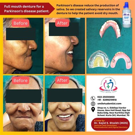 A complete teeth denture, and tooth implant clinic in Kurla, Mumbai