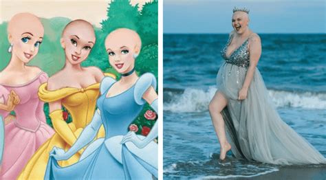 Cancer Fighter Wants Disney to Create a Bald Princess - Inside the Magic