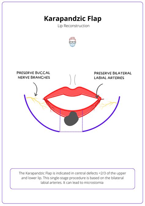 Lip Reconstruction · Anatomy, Indications, Algorithm