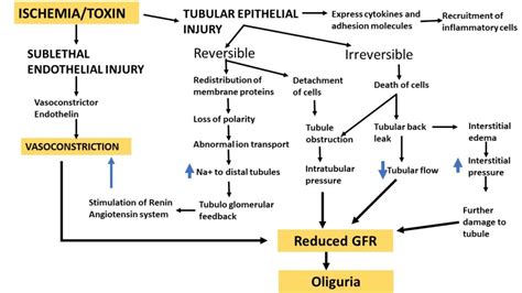 Pathology of Acute tubular injury/necrosis - Pathology Made Simple