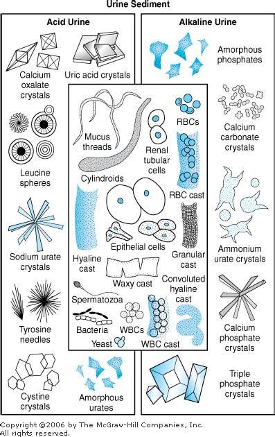 What might you see in Urine Sediment | Medical Laboratories