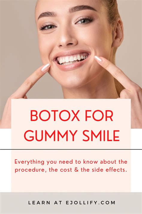 Botox For Gummy Smile • The Complete Guide | Gummy smile, Botox, Gummy smile botox