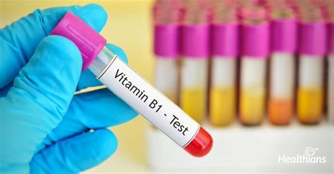 Vitamin B12 Test – Need, Results & Reference Range