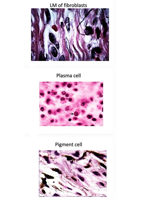 SOLUTION: Practical connective tissue histology - Studypool