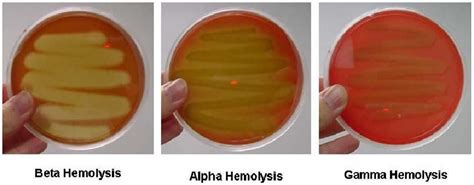 Media Blood Agar Plate (BAP) ~ Medical Laboratory Technologist