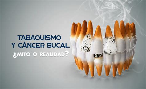 CANCER ORAL PRODUCIDO POR EL TABAQUISMO - Hispano Dental