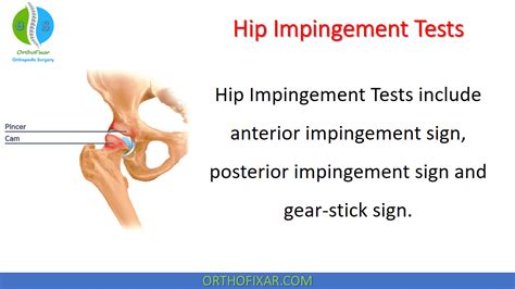 Hip Impingement Tests | OrthoFixar 2024