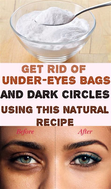 Get Rid of Under-Eyes Bags and Dark Circles Using This Natural Recipe ...