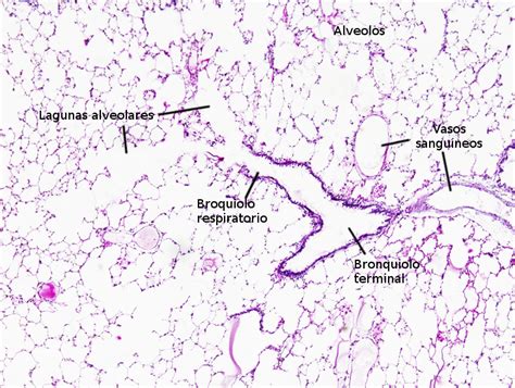 Pulmón | Histología, Sistema respiratorio, Anatomia patologica